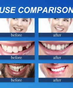 Fearaiy™ --Advanced Customized Full Denture Set